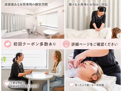 アキュエ(ACUE)の写真