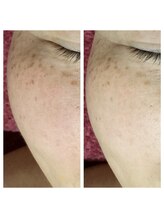 紫檀(シタン)/くすみ♪透明感♪美肌！