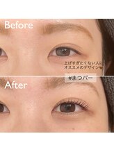 アントゥドゥ(antod)/