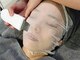 痩身 フェイシャル専門店 ビューティーサロン モアナ(beauty salon moana)の写真/すっきり小顔に♪毛穴汚れも改善！【毛穴引き締め/Wピーリング&イオン導入&マスク¥12000→¥8800】