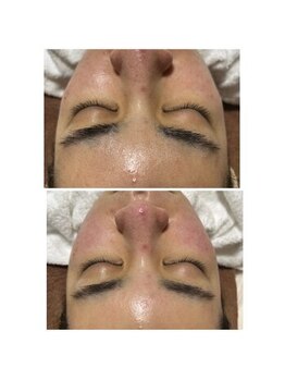 キャラメ(private salon Carame)/ビフォー・アフター