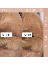 フェリス(FELIZ)/目元の年齢肌