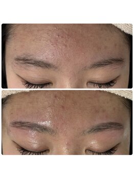 シャトン(Chaton)/