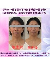 ハナノ整体院/引き上がった顔が最高