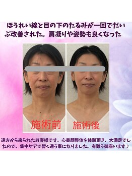 ハナノ整体院/引き上がった顔が最高
