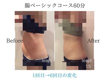リープル(Leapl)/【腸もみ】腸もみ後の変化写真