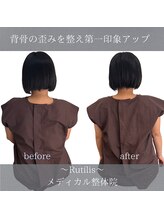 ルチルス(Rutilis)/整体ビフォーアフター◎