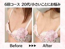 美人バスト リグラス(ReGrous)/バストアップbefore,after