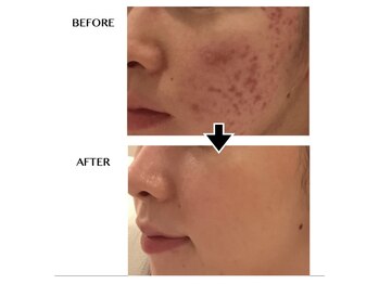 ウニ(uni)/【オーダーメイド肌管理】