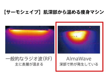 ビューティーリバース FORMEN 東戸塚店/サーモシェイプ