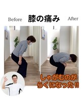 三条かがやき整体院/膝の痛み改善