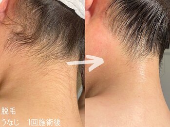 ルーナジェーナ(Luna llena)/池袋　エステ　ルーナジェーナ