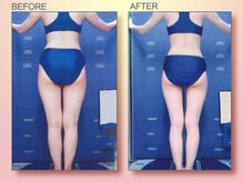 ジュリア オージェ 難波店/ビフォーアフター（脂肪燃焼）