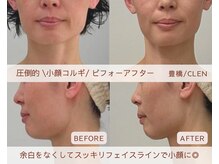 クレン(CLEN)の雰囲気（リラクゼーションしながら小顔コルギ！むくみ・余白の改善）