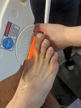 ミヤビ 竹ノ塚店(MIYA美)/脱毛で指毛も！