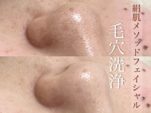 グロワール(Gloire)の雰囲気（皮脂が浮き出るクレンジングで理想のつるピカ小鼻に！）