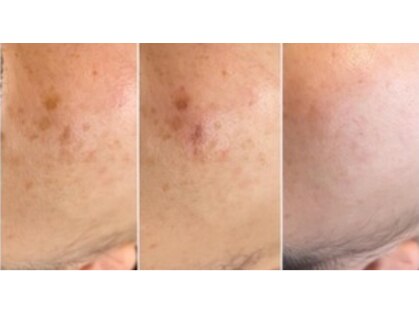 レアリゼアムール(Realiseramour)の写真