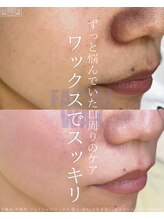 エリス(ELISSE)/口周りのケアは、サロンにお任せ