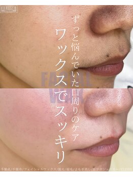 エリス(ELISSE)/口周りのケアは、サロンにお任せ