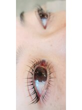 コア(Koa)/上下パリジェンヌリフト