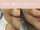 ベアール(beal)の写真/【人気No.1】もう隠さない！ほうれい線・くま・たるみを徹底改善！土台から整え、鏡を見るのが楽しみに♪