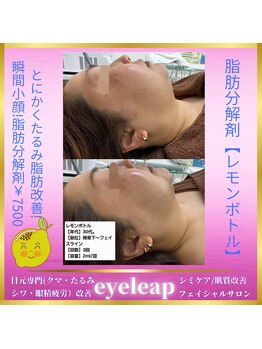 アイリープ(eyeleap)/☆レモンボトルビフォーアフター