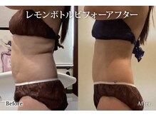 アネル 浦添店(anel)/会員様レモンボトル3ヶ月の結果