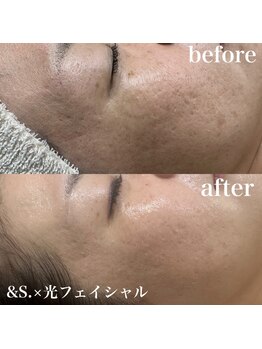 アンドエス(&S.)/お肌のお悩み諦めないで!