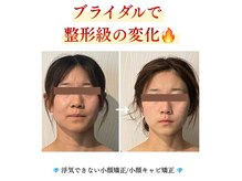 アンジェリオーラ(angeli aura)の雰囲気（【小顔矯正】たるみやシワのお悩みの方も筋膜リリースで改善！）