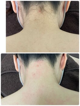 エン(en.)/BeforeAfter写真34