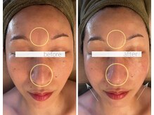 パル コルギサロン(Pal. Korugi salon)/コルギ&ハーブトリートメント