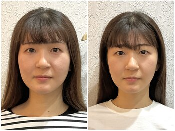 美容整体ウェリナ 名駅院/小顔矯正/骨盤矯正/美脚サロン