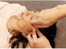 まるはりきゅう治療院