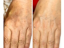 ステラルーテ(Stella lute)