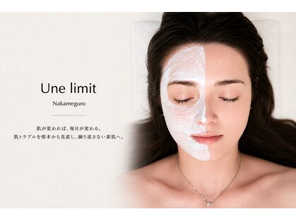 アンリミット 中目黒店(Une limit)の写真