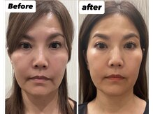 アランチャンティック(AlamCantik)の雰囲気（【テラボーラー3回目でこの効果】小顔矯正/頭蓋骨矯正）