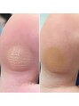ルシェノン(Le chainon) 足裏の角質ケアもお任せください♪