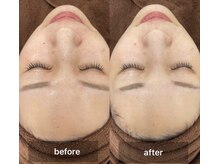 ジョリーワックス(jolie wax)/