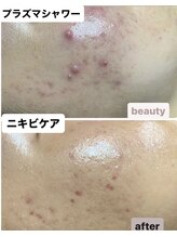 マニス(manis)/プラズマシャワー