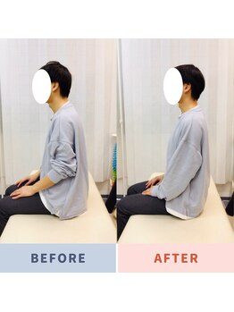 ナオル整体 三鷹院(NAORU整体)/20代男性施術事例【猫背姿勢】