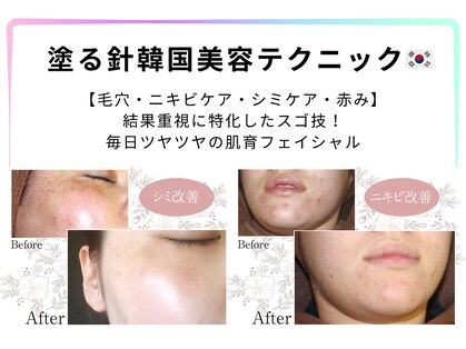 アルクラールの写真