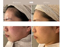 アンク(Ankh)/肌改善はこちらから！敏感肌も◎