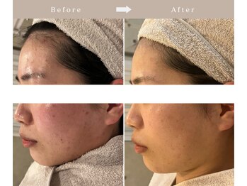 アンク(Ankh)/肌改善はこちらから！敏感肌も◎