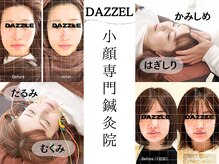 ダズル(DAZZLE)