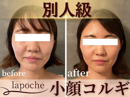 ラポッシュ(La poche)の写真