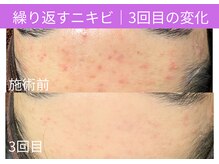 おうちサロン ミキ