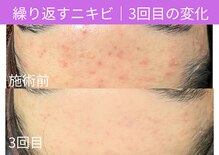 おうちサロン ミキ