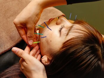 ハリトマト 梅田中崎の写真/食いしばるエラやもたつく輪郭の改善に★顔の凝りを鍼で解き、首まで流して、研ぎ澄まされた小顔を再現◎