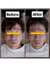 ぷめはな整体/before/After