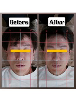 ぷめはな整体/before/After